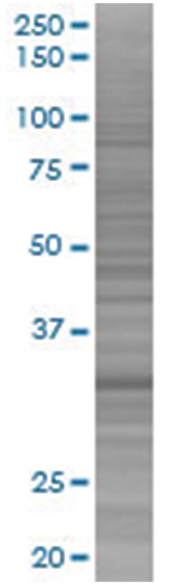 KLHL3 293T Cell Overexpression Lysate (Denatured), Abnova 100 &mu;l | Buy Online | Abnova | Fisher Scientific