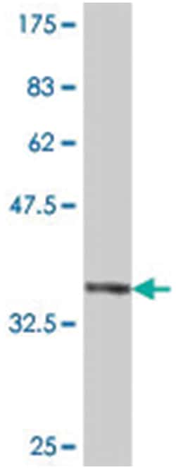 F-box and WD repeat domain containing 8, Mouse, Polyclonal Antibody, Abnova 50 &mu;L | Buy Online | Abnova | Fisher Scientific