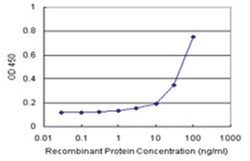 anti-FBXO6 Matched Antibody Pair, Abnova