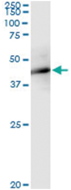 FBXO4, Human, IP-WB Antibody Pair (PW2), Abnova&trade;