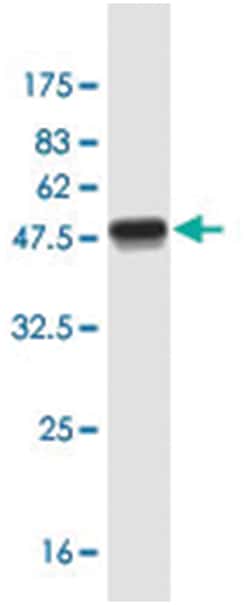 FGF21, Mouse, Clone: 3E20, Abnova 200&mu;L; Unlabeled:Antibodies, Monoclonal