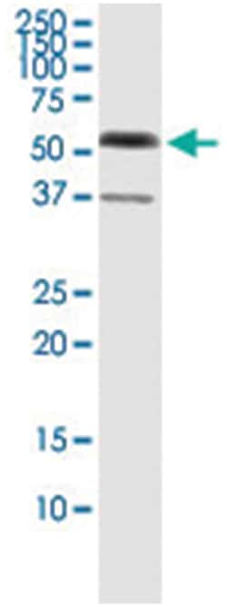 anti-GAPDHS, Human, IP-WB Antibody Pair, Abnova&trade;