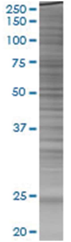 HSPB8 293T Cell Overexpression Lysate (Denatured), Abnova