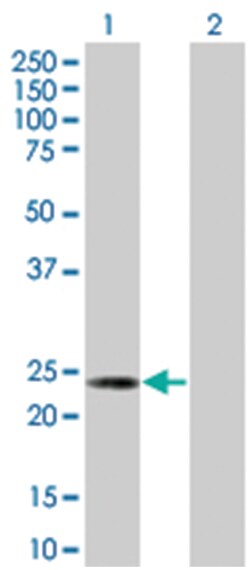 HSPB8 293T Cell Overexpression Lysate (Denatured), Abnova 100 &mu;L | Buy Online | Abnova | Fisher Scientific