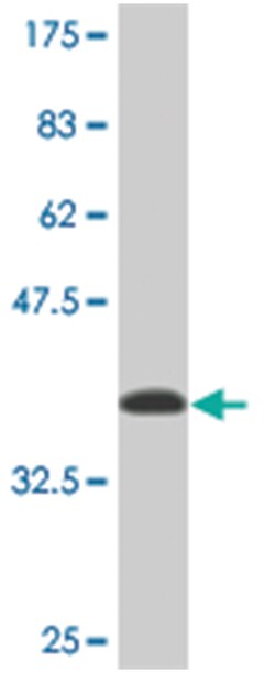 nuclear prelamin A recognition factor, Mouse, Clone: 7D9, Abnova 200&mu;L;