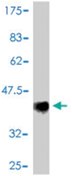 TIMM13, Mouse, Polyclonal Antibody, Abnova 50&mu;L; Unlabeled:Antibodies,