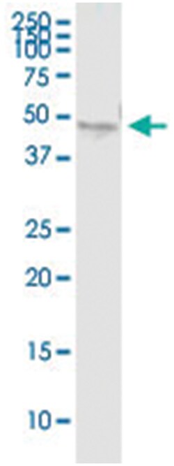 anti-TBL2, Human, IP-WB Antibody Pair, Abnova 1 Set | Buy Online | Abnova | Fisher Scientific