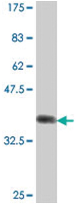 RNF11, Mouse, Polyclonal Antibody, Abnova 50&mu;L; Unlabeled:Antibodies,
