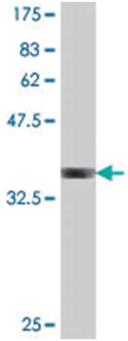 CYFIP2, Mouse, Polyclonal Antibody, Abnova 50&mu;L; Unlabeled:Antibodies,