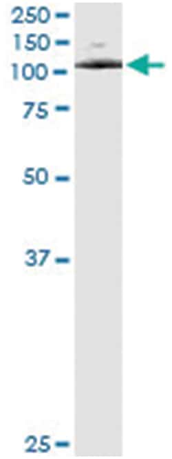 anti-ATP2C1, Human, IP-WB Antibody Pair, Abnova&trade;