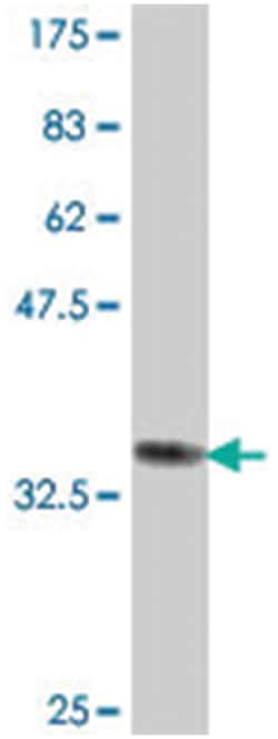 PPA2, Mouse, Polyclonal Antibody, Abnova 50&mu;L; Unlabeled:Antibodies,