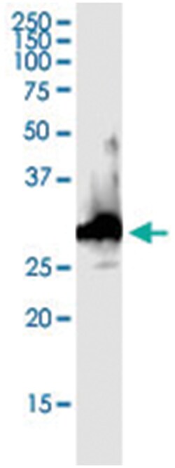 anti-CACYBP, Human, IP-WB Antibody Pair, Abnova™