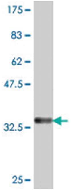 PDE7B, Mouse, Polyclonal Antibody, Abnova 50 &mu;L | Buy Online | Abnova | Fisher Scientific