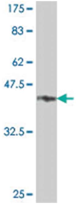 INVS, Mouse, Polyclonal Antibody, Abnova 50&mu;L; Unlabeled:Antibodies,