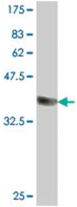 CPNE7, Mouse, Polyclonal Antibody, Abnova 50&mu;L; Unlabeled:Antibodies,