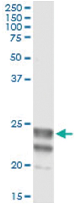 anti-NAAA, Human, IP-WB Antibody Pair, Abnova&trade;