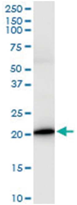 anti-IL17C, Human, IP-WB Antibody Pair, Abnova&trade;