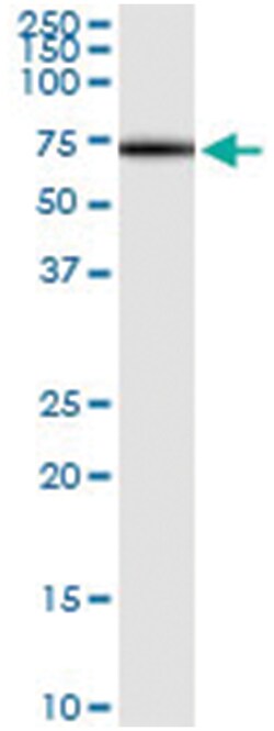 anti-SESN1, Human, IP-WB Antibody Pair, Abnova™