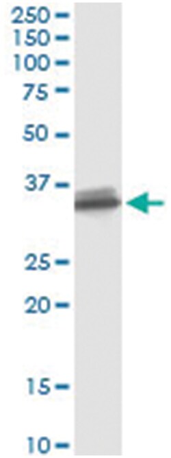 anti-SULT1B1, Human, IP-WB Antibody Pair, Abnova™