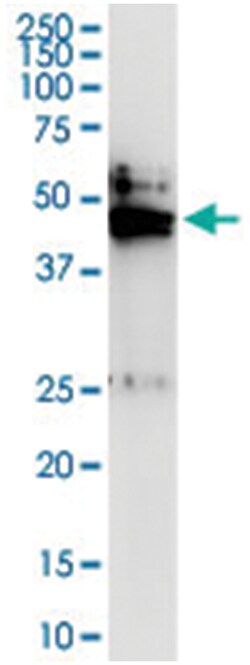 anti-SMPDL3B, Human, IP-WB Antibody Pair, Abnova 1 Set:Antibodies, Monoclonal/Polyclonal