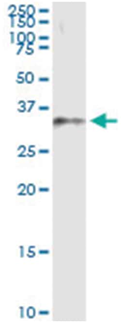 anti-DHDH, Human, IP-WB Antibody Pair, Abnova 1 Set:Antibodies, Monoclonal/Polyclonal