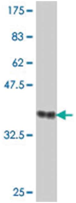 ADAMDEC1, Mouse, Polyclonal Antibody, Abnova 50 &mu;L | Buy Online | Abnova | Fisher Scientific