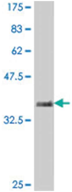 PCDH11X, Mouse, Polyclonal Antibody, Abnova 50&mu;L; Unlabeled:Antibodies,