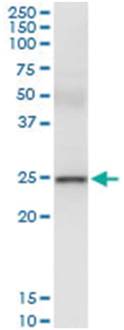 anti-UBE2S, Human, IP-WB Antibody Pair, Abnova&trade;