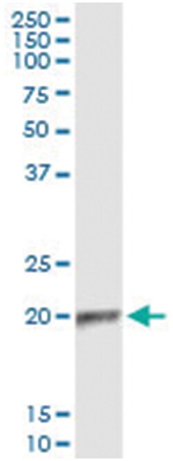 APOBEC3C, Human, IP-WB Antibody Pair (PW2), Abnova&trade;