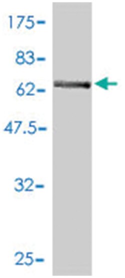 MAT2B, Mouse, Polyclonal Antibody, Abnova 50 &mu;L | Buy Online | Abnova Corporation | Fisher Scientific