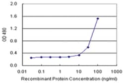 anti-PPP2R3B Ab-2 Matched Antibody Pair, Abnova&trade;