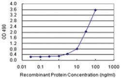 anti-PPP2R3B Ab-4 Matched Antibody Pair, Abnova&trade;