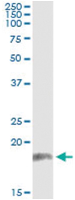 PPP2R3B, Human, IP-WB Antibody Pair (PW1), Abnova&trade;