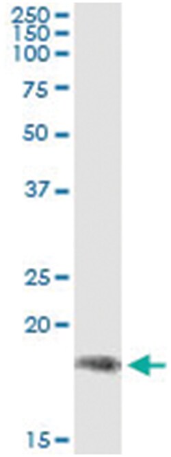 PPP2R3B, Human, IP-WB Antibody Pair (PW2), Abnova 1 Set | Buy Online | Abnova | Fisher Scientific