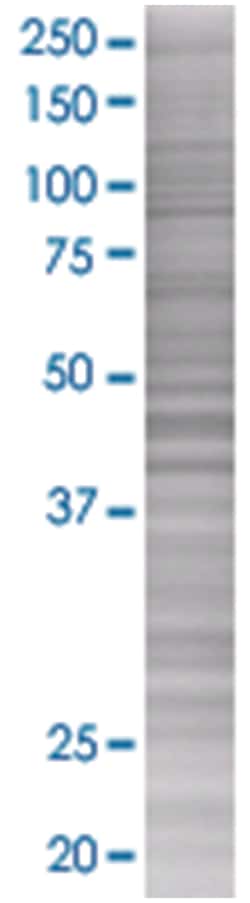 PPP2R3B 293T Cell Overexpression Lysate 2 (Denatured), Abnova