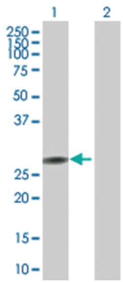 PPP2R3B 293T Cell Overexpression Lysate 2 (Denatured), Abnova