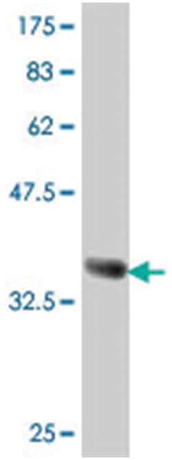 DLL1, Mouse, Polyclonal Antibody, Abnova™
