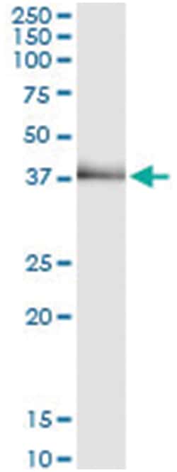 anti-TRIB2, Human, IP-WB Antibody Pair, Abnova&trade;