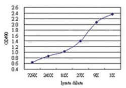 anti-MAGEH1 Matched Antibody Pair, Abnova&trade;