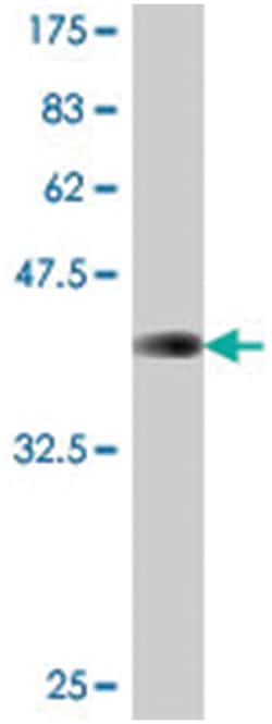 COMMD5, Mouse, Polyclonal Antibody, Abnova 50&mu;L; Unlabeled:Antibodies,