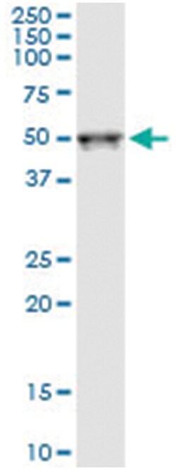 anti-KLF15, Human, IP-WB Antibody Pair, Abnova&trade;