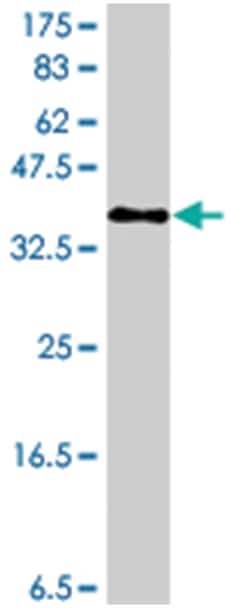 C20orf30, Mouse, Polyclonal Antibody, Abnova 50 &mu;L | Buy Online | Abnova | Fisher Scientific