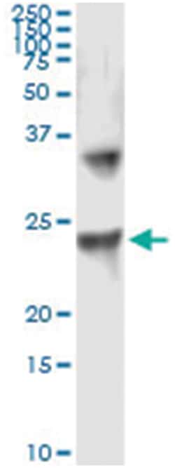 UBE2T, Human, IP-WB Antibody Pair (PW1), Abnova 1 Set:Antibodies, Monoclonal/Polyclonal