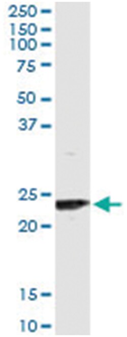 UBE2T, Human, IP-WB Antibody Pair (PW2), Abnova&trade;