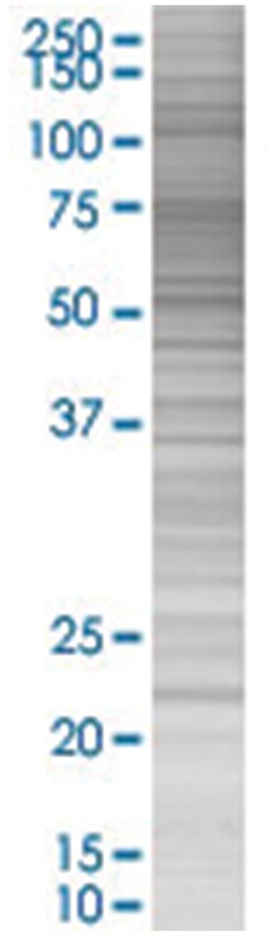 HEMK2 293T Cell Overexpression Lysate (Denatured), Abnova