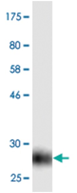 anti-CD274, Clone: 3C10, Abnova 100 &mu;g | Buy Online | Abnova Corporation | Fisher Scientific