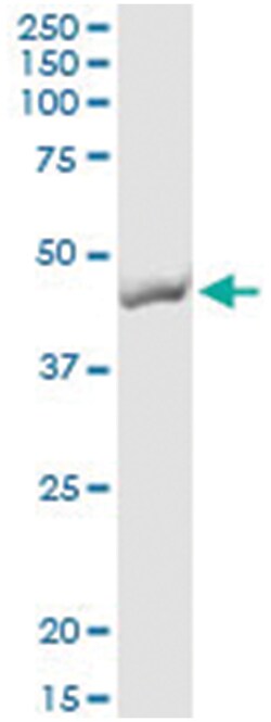 anti-TMOD2, Human, IP-WB Antibody Pair, Abnova&trade;