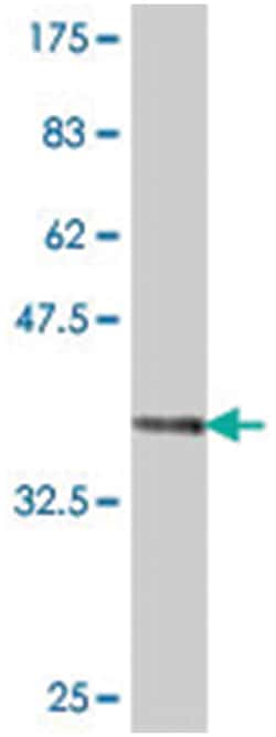 ALG5, Mouse, Polyclonal Antibody, Abnova 50&mu;L; Unlabeled:Antibodies,
