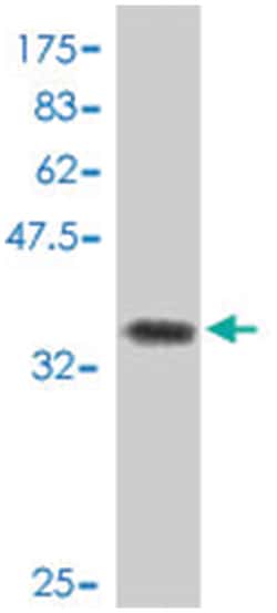 CNOT7, Mouse, Polyclonal Antibody, Abnova 50&mu;L; Unlabeled:Antibodies,