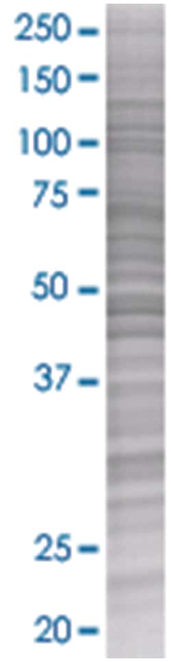 SNX15 293T Cell Overexpression Lysate 2 (Denatured), Abnova 100 &mu;L | Buy Online | Abnova | Fisher Scientific